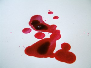 Come eliminare macchie di sangue dalla seta